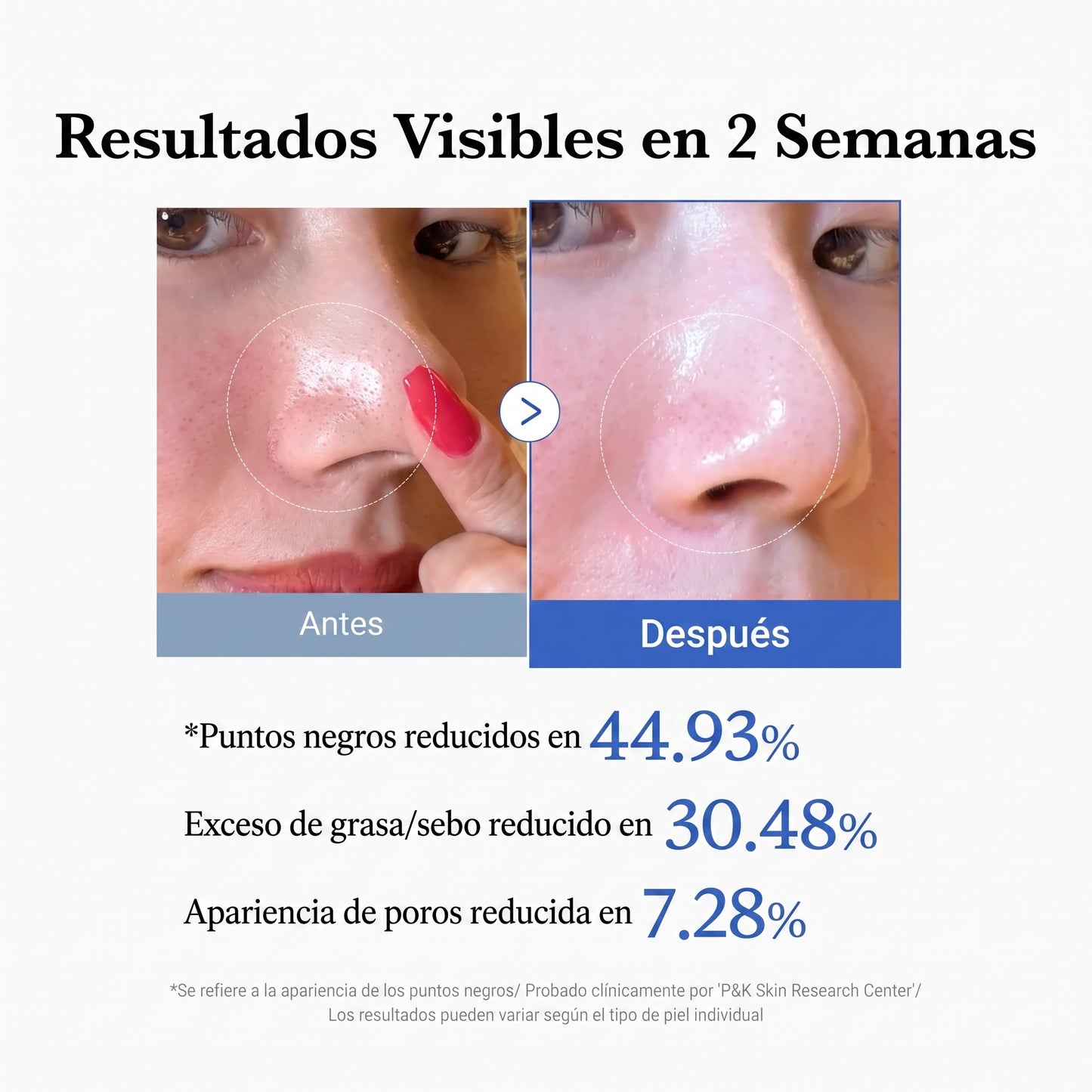 Zero Pore Pad 2.0 (70 pads) — Medicube
