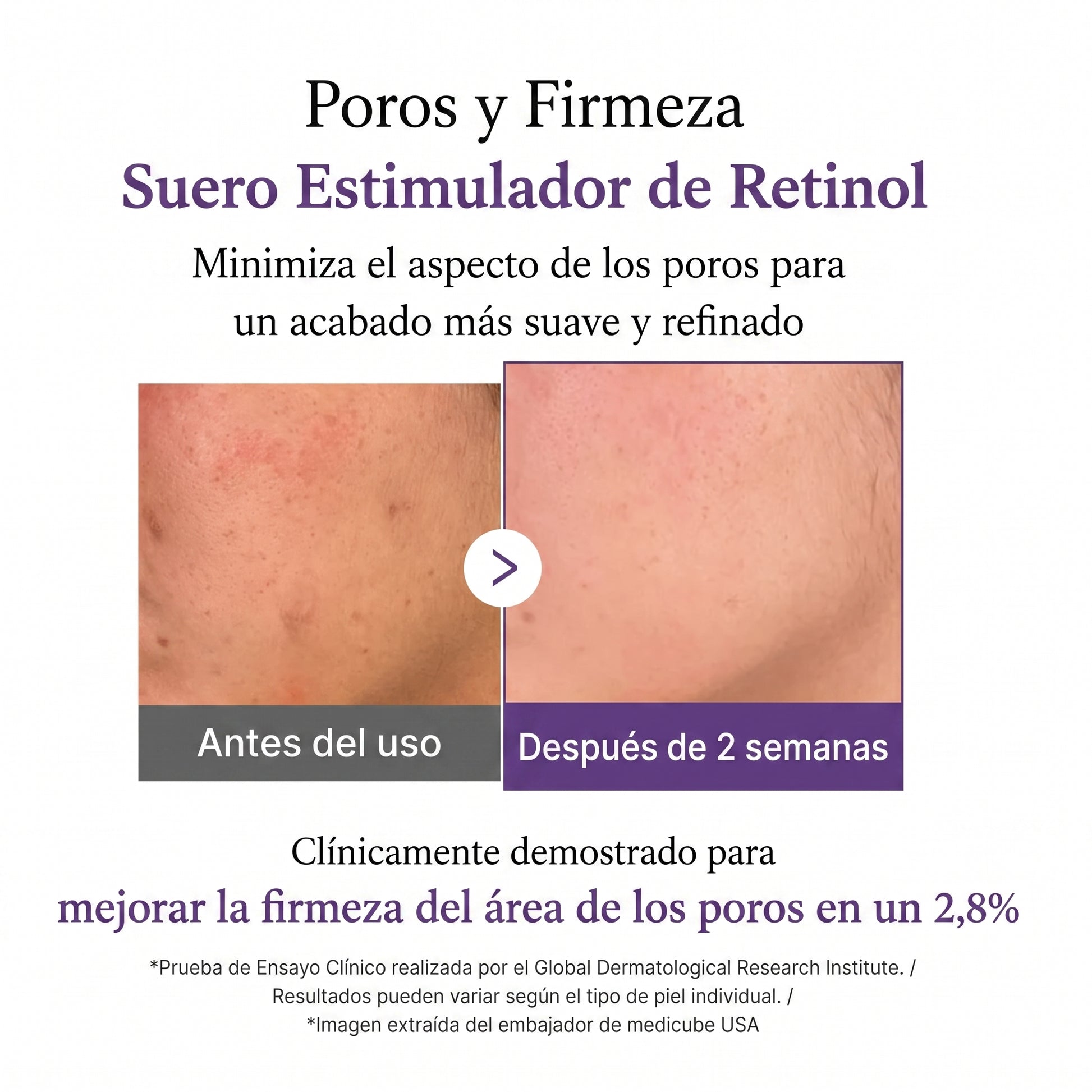 Retinol Boosting Serum — Medicube